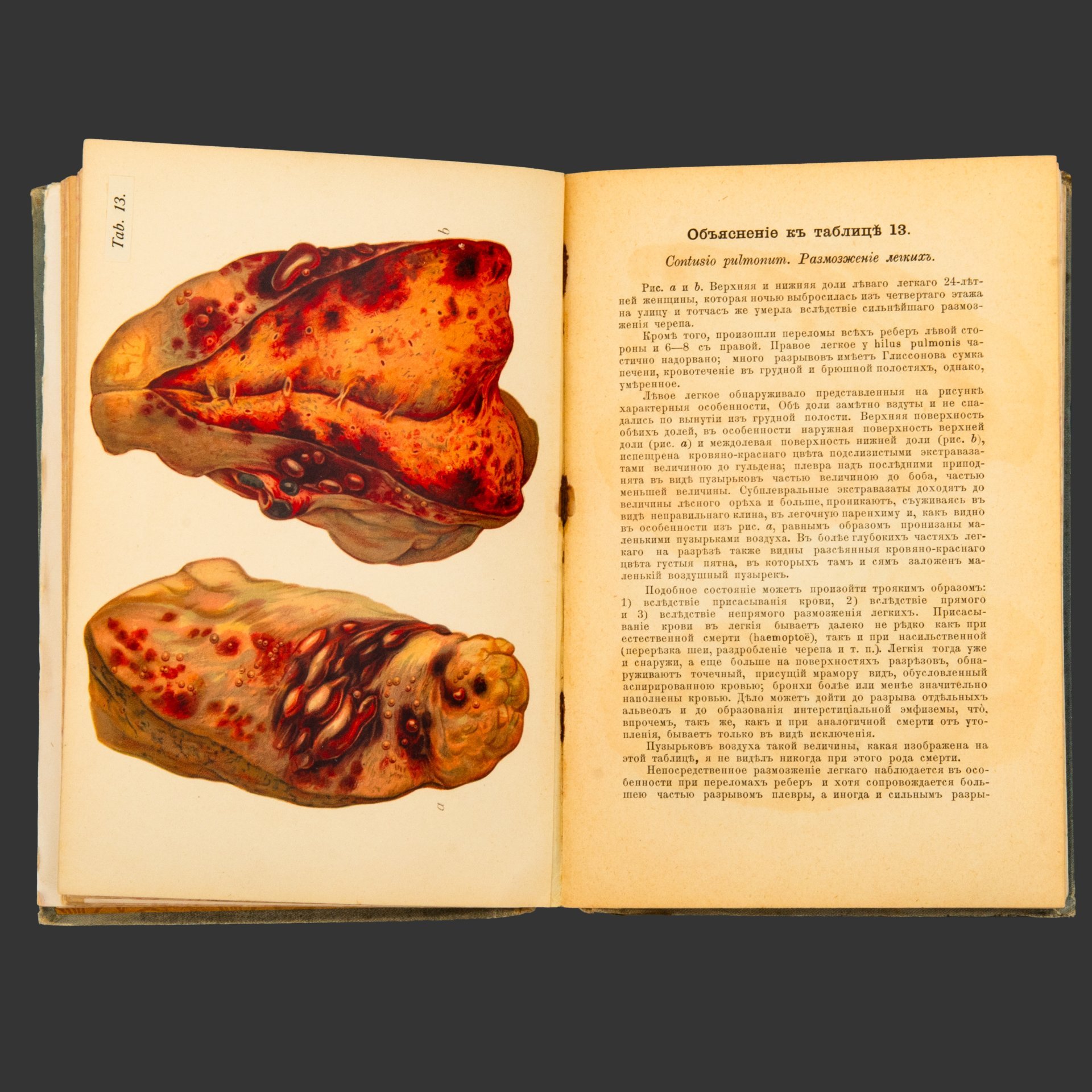 Книга, Прфессор E. Von Hofmann [56 таблиц, 193 рисунка], бумага, печать, Издательство «Практическая медицина», Российская империя, 1900 г.