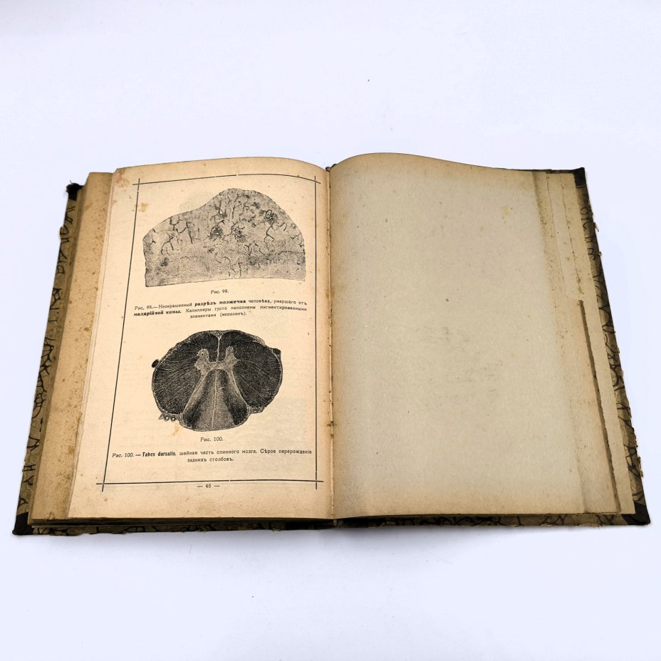 Исаев С. Краткое руководство по патологической анатомии (общей и частной), бумага, печать